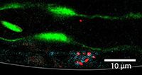 Nanoparticules, outils d’innovation bénéfiques ou dangereux